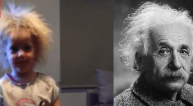 Einstein's style Girl ! Australian girl suffers from "difficult to comb her hair syndrome"