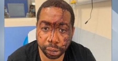 French police beat an African-American man and caused protest. The police involved were charged.